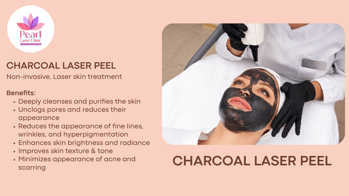 Carbon laser peel treatment at Pearl Laser Clinic